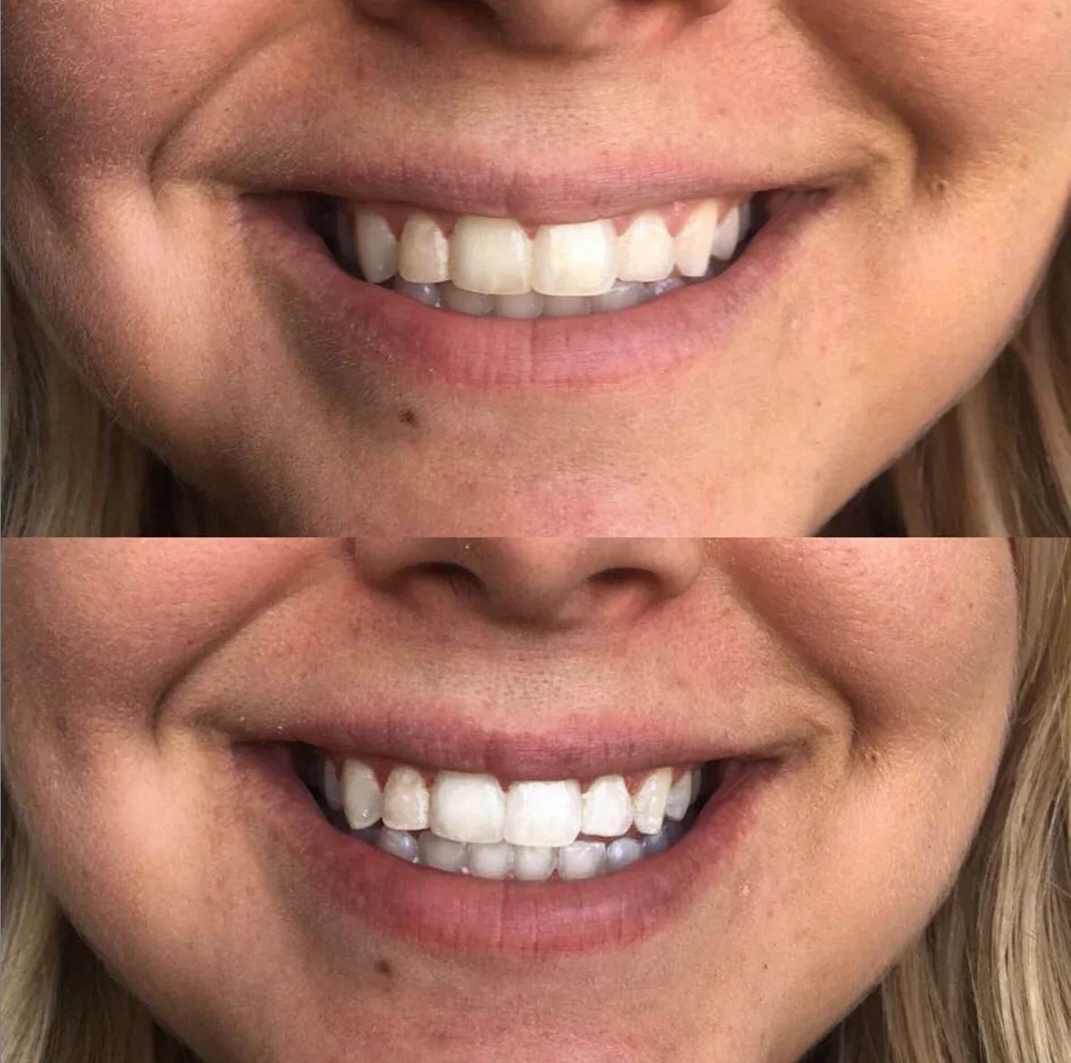 cozy smile kit on Simply Obsessed