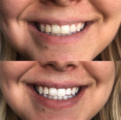 cozy smile kit on Simply Obsessed